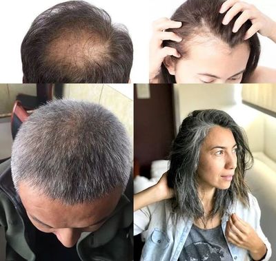 洗头水中撒一把，头发长得又快又茂密，白发都没了！